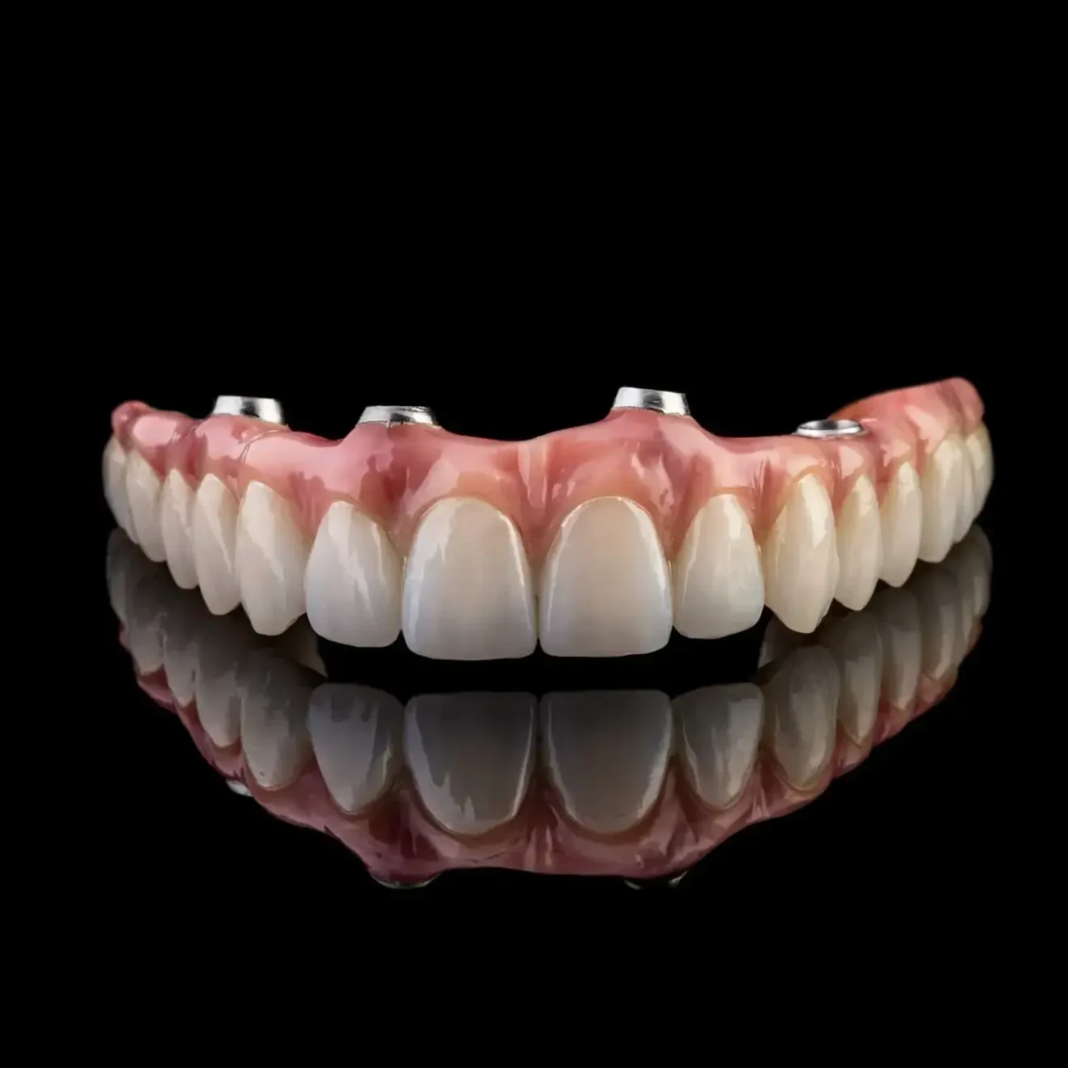 All-on-4 zirconia implant bridge